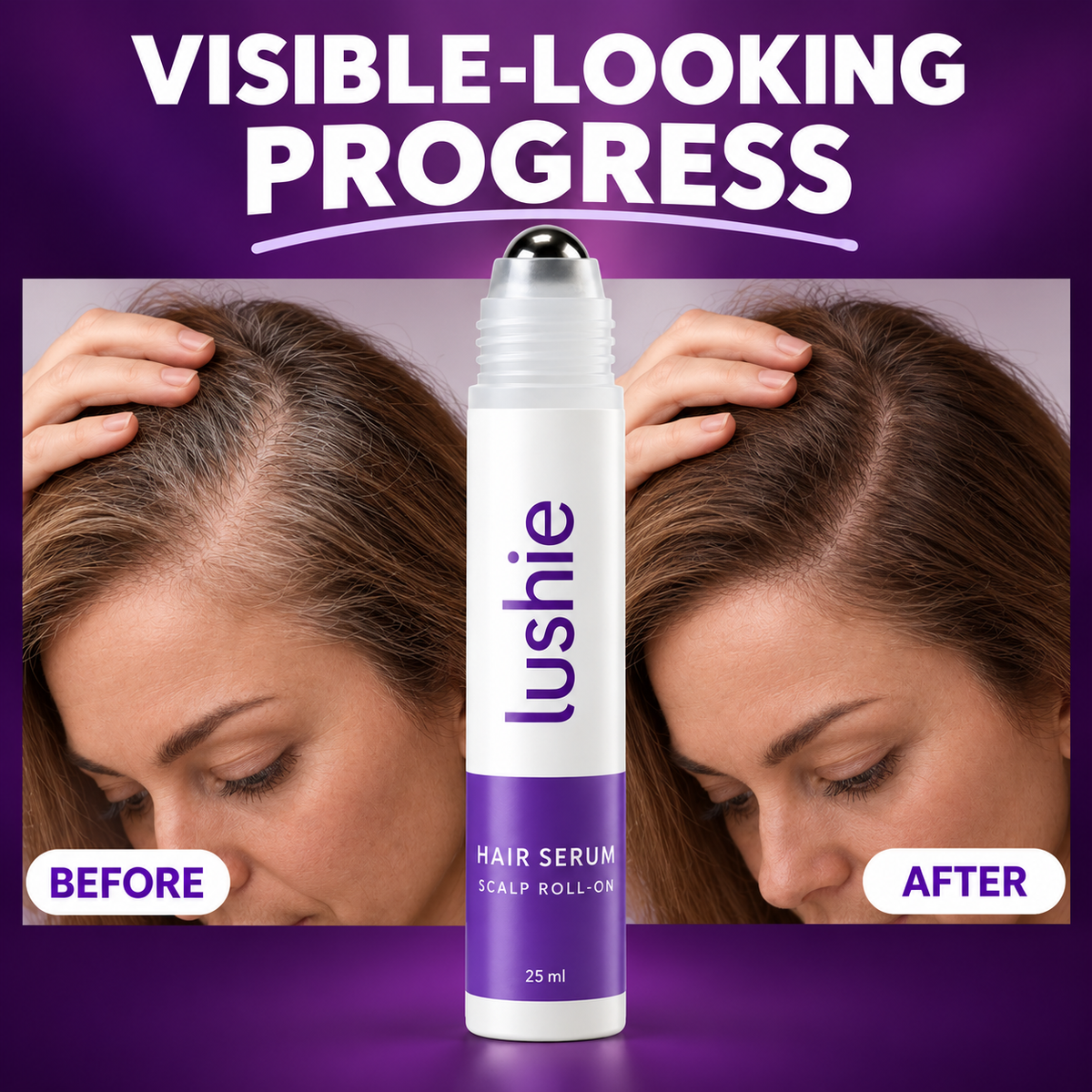 Lushie hairline progress result